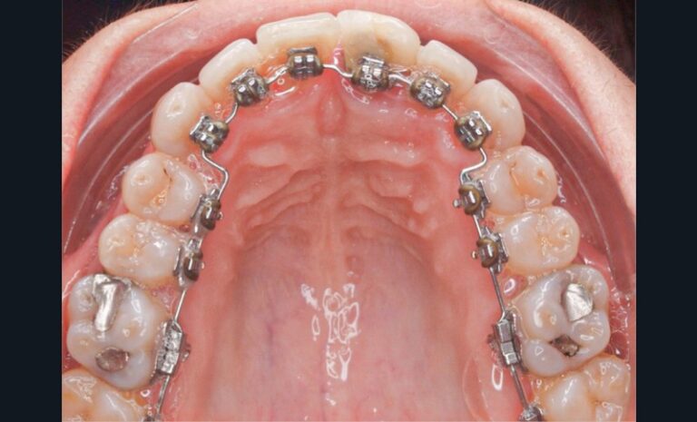 Figure_3_-_situation_clinique_pré-chirurgicale1-tt-width-800-height-484-fill-1-cr