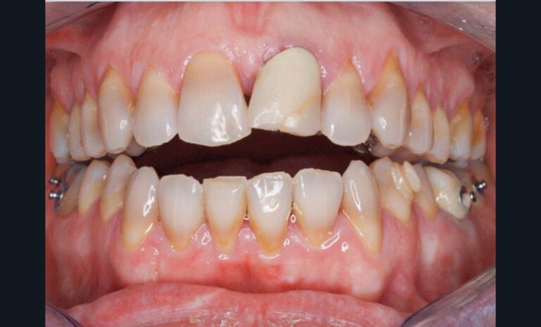 Figure_3_-_situation_clinique_pré-chirurgicale2-tt-width-800-height-484-fill-1-cr