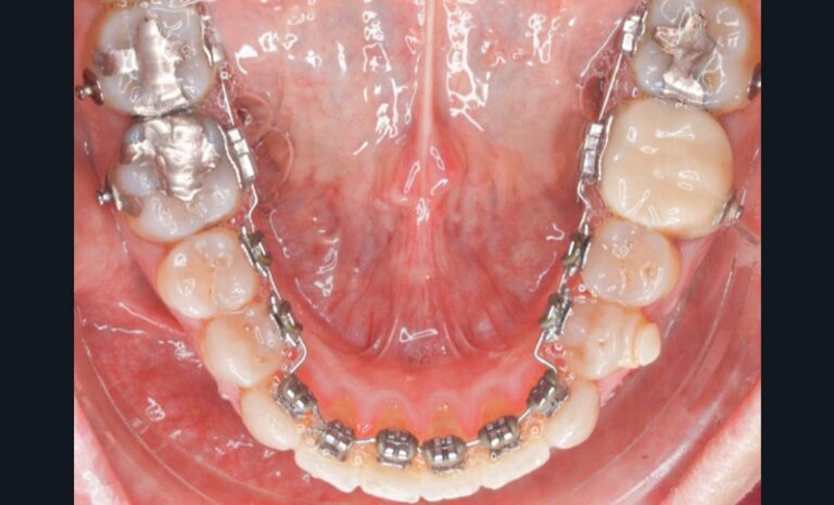 Figure_3_-_situation_clinique_pré-chirurgicale3-tt-width-800-height-484-fill-1-cr