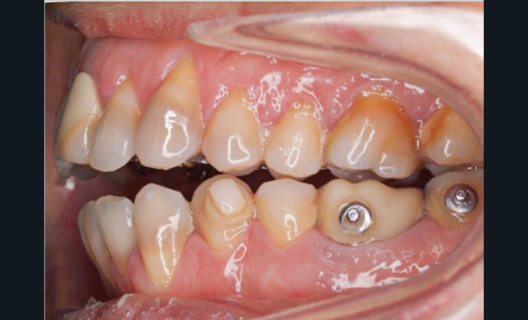 Figure_3_-_situation_clinique_pré-chirurgicale4-tt-width-800-height-484-fill-1-cr