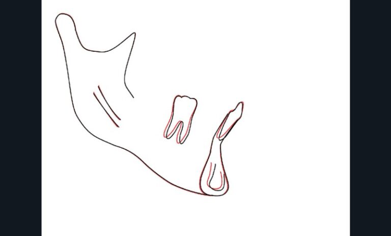 Figure_6-_Superpo2-tt-width-800-height-484-fill-1-crop-0-bgcolor-12181f-isLogoProx