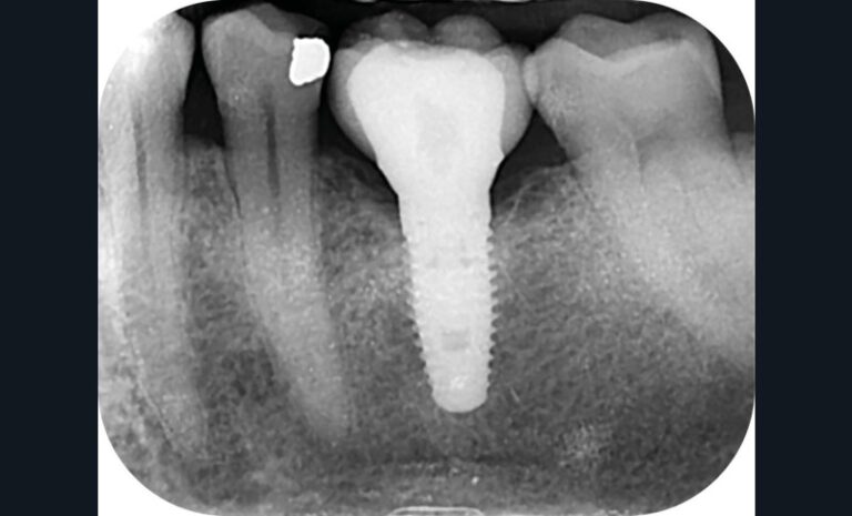 1. Radiographie initiale.
