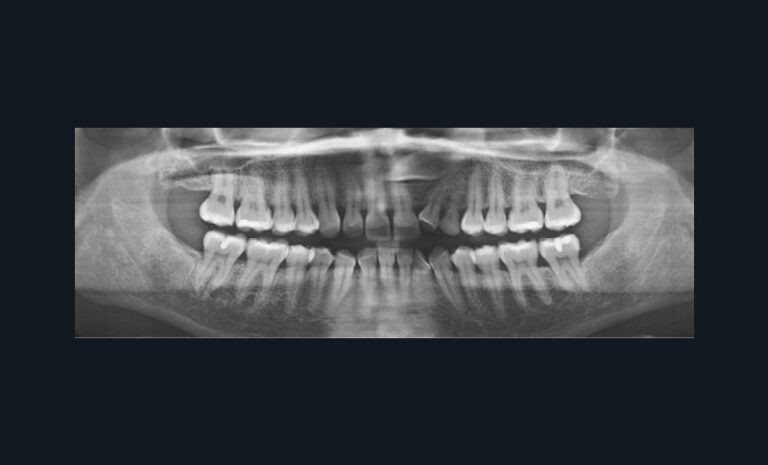 2. c)