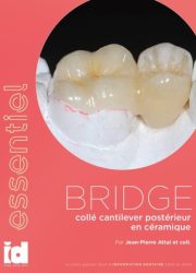 bridge-cantilever-bd-tt-width-680-height-874-fill-0-crop-1-bgcolor-eeeeee-isLogoProxy-0-post_id-163447